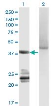 Anti-GNA14 Mouse Monoclonal Antibody [clone: 2H8]