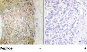 Anti-HSPB6 Rabbit Polyclonal Antibody