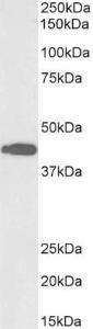 Antibody anti-ACAT1 A84740-100 100 µg