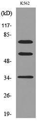 Anti-FAF1 antibody