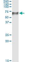 Anti-TCN1 Antibody Pair