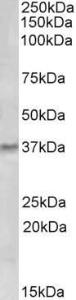 Anti-GCH1 Antibody (A83147) (0.5 µg/ml) staining of Human Tonsil lysate (35 µg protein in RIPA buffer). Primary incubation was 1 hour. Detected by chemiluminescence