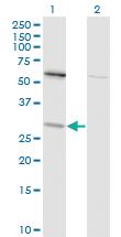 Anti-TPMT Mouse Monoclonal Antibody [clone: 1B5]