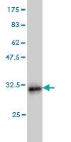 Anti-LMO3 Mouse Monoclonal Antibody [clone: 3G7]