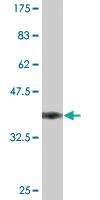 Anti-NOS3 Mouse Monoclonal Antibody [clone: 1D12]