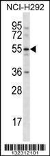 Anti-CLEC18A Rabbit Polyclonal Antibody (Biotin)