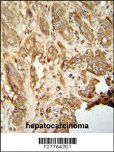 Anti-NAT14 Rabbit Polyclonal Antibody (Biotin)