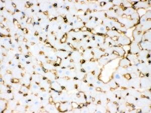 Anti-ANXA3 Rabbit Polyclonal Antibody