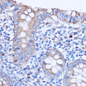 Immunohistochemistry analysis of paraffin-embedded human appendix tissue using Anti-MT-ND3 Antibody (A92816) at a dilution of 1:100 (40x lens). Perform microwave antigen retrieval with 10 mM PBS buffer pH 7.2 before commencing with IHC staining protocol.