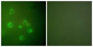 Antibody anti-GRP78 100 µg