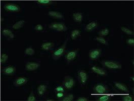 Anti-EIF4EBP1 Mouse Monoclonal Antibody [clone: 4F3-H2]