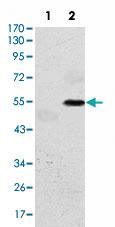 Anti-EIF2AK3 Mouse Monoclonal Antibody [clone: 5G5]