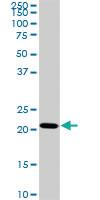 Anti-TRAPPC4 Mouse Monoclonal Antibody [clone: 2D10]