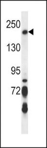 Anti-BRIP1 Rabbit Polyclonal Antibody