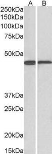 Anti-ACAT1 Antibody (A84741) (01 µg/ml) staining of Mouse (A) and Rat (B) Liver lysate (35 µg protein in RIPA buffer) Primary incubation was 1 hour Detected by chemiluminescence