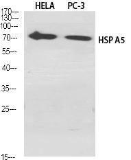 Antibody anti-GRP78 100 µg