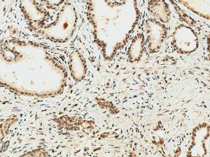 Immunohistochemistry analysis of human prostate, fixed in formalin and paraffin-embedded. The Primary Antibody used was Anti-HO-2 Antibody (A304991) at 1:50 for 30 minutes at room temperature. Counterstain: Hematoxylin. Magnification: 20X. HRP-DAB Detection