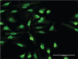 Anti-OXSR1 Mouse Monoclonal Antibody [clone: 1F6]