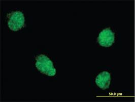 Anti-TWIST1 Mouse Monoclonal Antibody [clone: 4G10]