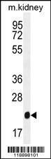 Anti-GPX3 Rabbit Polyclonal Antibody