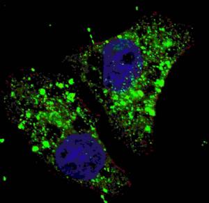 Anti-MAP1LC3A Rabbit Polyclonal Antibody (AP (Alkaline Phosphatase))