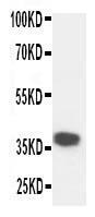 Anti-Kallikrein 5 Rabbit Polyclonal Antibody