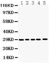 Anti-APH1A Rabbit Polyclonal Antibody