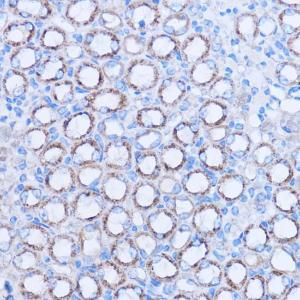 Immunohistochemistry analysis of paraffin-embedded mouse kidney using Anti-MT-ND3 Antibody (A92816) at a dilution of 1:100 (40x lens). Perform microwave antigen retrieval with 10 mM PBS buffer pH 7.2 before commencing with IHC staining protocol.