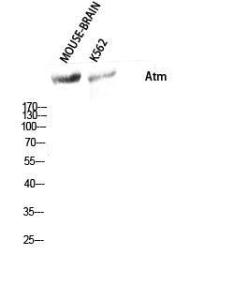 Western blot analysis of mouse brain K562 cells using Anti-ATM Antibody