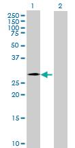 Anti-CHMP4C Mouse Polyclonal Antibody