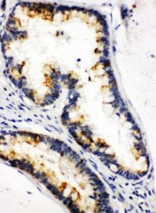 Anti-Kallikrein 6 Rabbit Polyclonal Antibody