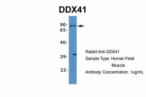 Anti-DDX41 Rabbit Polyclonal Antibody