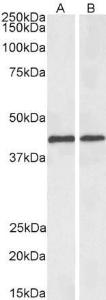 Anti-ACAT1 Goat Polyclonal Antibody (Biotin)