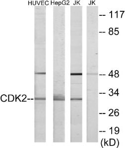 Western blot analysis of lysates from HUVEC, HepG and Jurkat cells using Anti-CDK2 Antibody. The right hand lane represents a negative control, where the Antibody is blocked by the immunising peptide