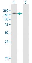 Anti-SEMA6A Rabbit Polyclonal Antibody