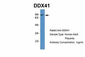 Anti-DDX41 Rabbit Polyclonal Antibody