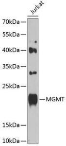 Western blot analysis of extracts of Jurkat cells, using Anti-MGMT Antibody (A8345) at 1:1,000 dilution