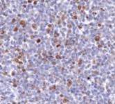 Anti-MKI67 Rabbit Polyclonal Antibody