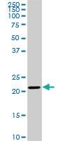 Anti-TRAPPC4 Mouse Monoclonal Antibody [clone: 2D10]