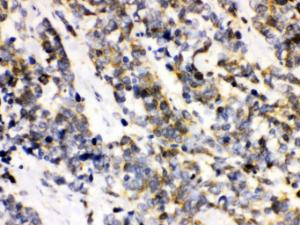 Anti-ATXN3 Rabbit Polyclonal Antibody