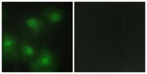 Immunofluorescence analysis of HeLa cells using Anti-CDK2 Antibody. The right hand panel represents a negative control, where the Antibody was pre-incubated with the immunising peptide