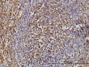 Anti-TPMT Mouse Monoclonal Antibody [clone: 1B5]