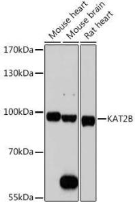 Western blot analysis of extracts of various cell lines, using Anti-KAT2B / PCAF Antibody (A8349) at 1:1,000 dilution. The secondary antibody was Goat Anti-Rabbit IgG H&L Antibody (HRP) at 1:10,000 dilution.