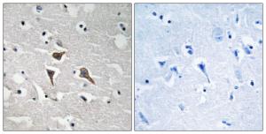 Immunohistochemical analysis of paraffin-embedded human brain tissue using Anti-ALK Antibody. The right hand panel represents a negative control, where the antibody was pre-incubated with the immunising peptide.