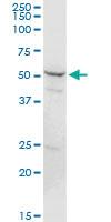 Anti-PSMD5 Rabbit Polyclonal Antibody