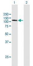 Anti-DDHD1 Mouse Polyclonal Antibody