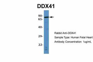 Anti-DDX41 Rabbit Polyclonal Antibody