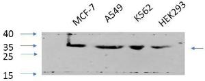 Western blot analysis of various cells using Anti-CDK2 Antibody at 1:1000 (4 °C overnight). Goat Anti-Rabbit IgG (IRDye 800) was used as a secondary at 1:5000 (25 °C, 1 hour)