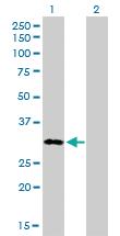 Anti-MEOX1 Mouse Monoclonal Antibody [clone: 1A10]