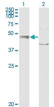 Anti-EDEM2 Mouse Monoclonal Antibody [clone: 2E4]